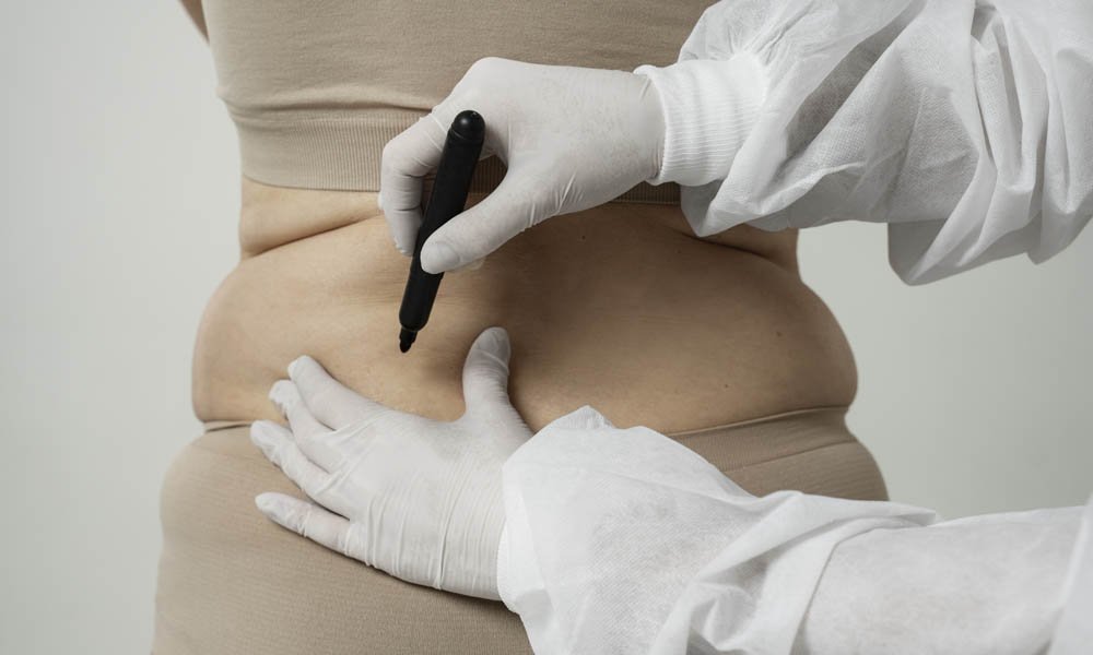 A-Guide-to-Body-Contouring-Procedures