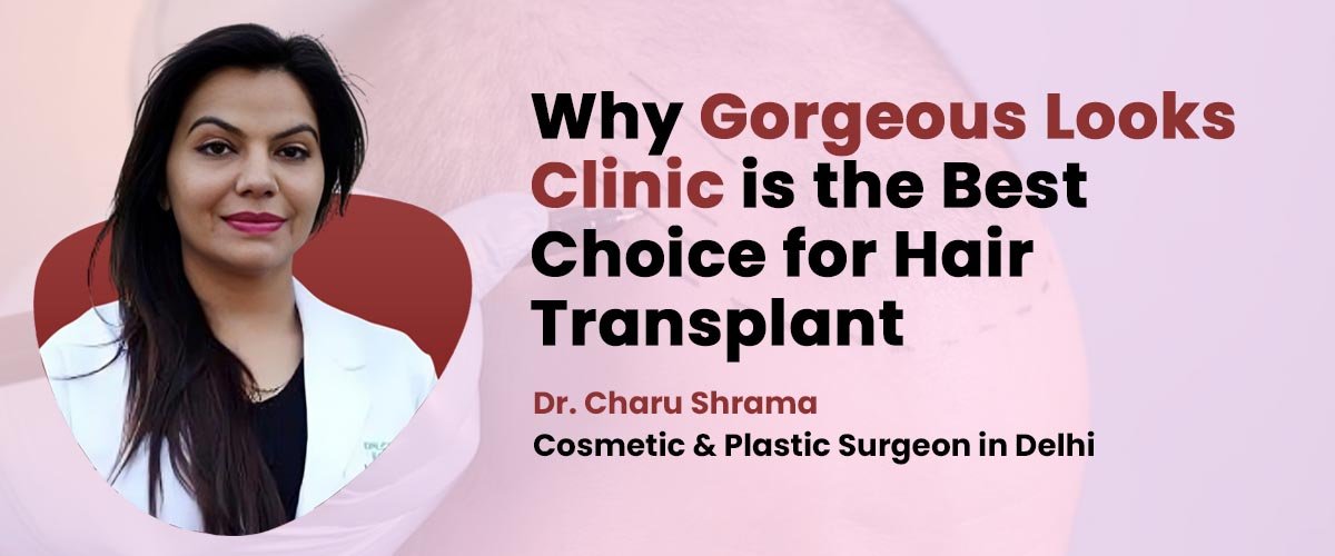 best hair transplant clinic in delhi