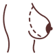 breast-augmentation-surgery-delhi