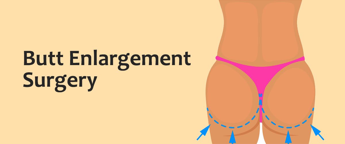 butt-enlargement-surgery