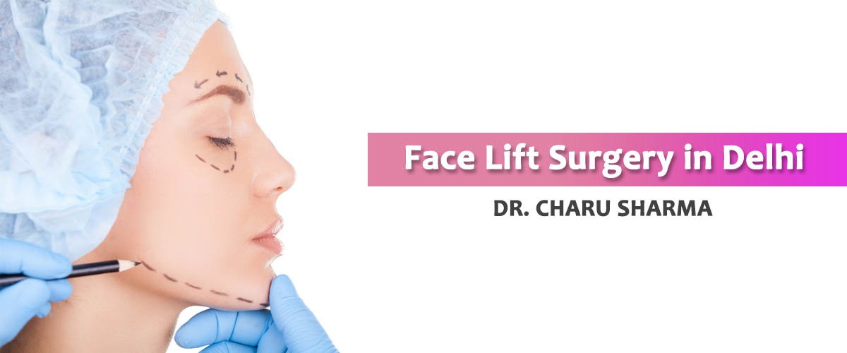 face-lift-surgery-delhi