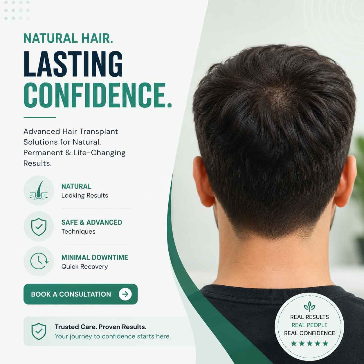 hair-transplant-clinic-delhi