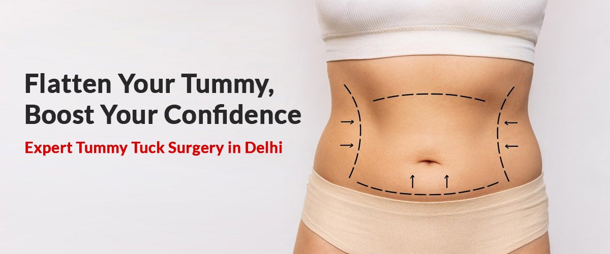 tummy-tuck-surgery-delhi